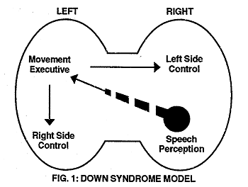 Fig. 1: Down Syndrome Model