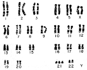 Появление в генотипе лишней хромосомы